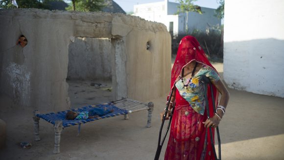 A 45-year-old lady is standing on crutches. She is wearing bright red clothes and a boy is asleep on a bed behind her.