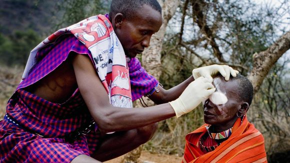A woman has her bandages removed after undergoing trachoma surgery in Kenya.