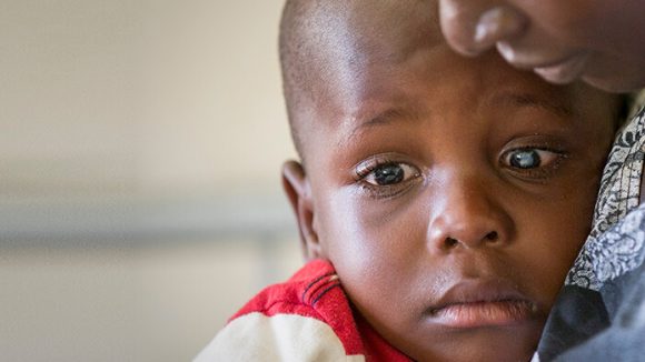 A child who is suffering from cataracts hugs his mother.