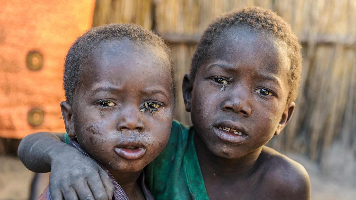 Inutu's younger brothers, Sililo and Maimbolwa are seen with visible indicators of trachoma.