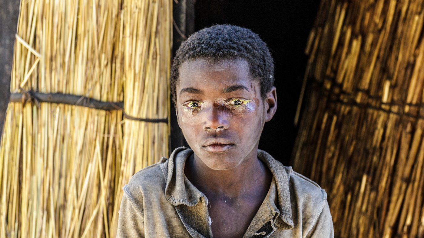 A close up of Inutu's eyes, showing a yellow crusty discharge around them.