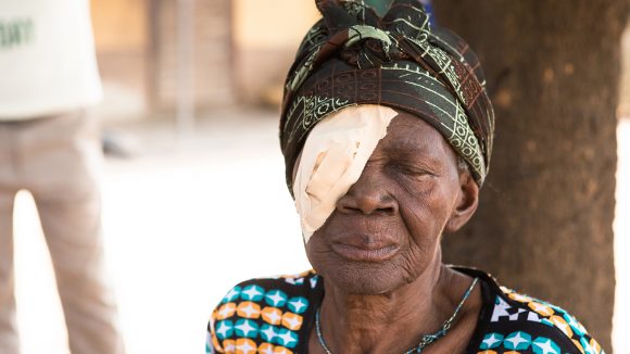 Ayishetu from Ghana sits beside a tree with a patch on her right eye following her trachoma surgery.