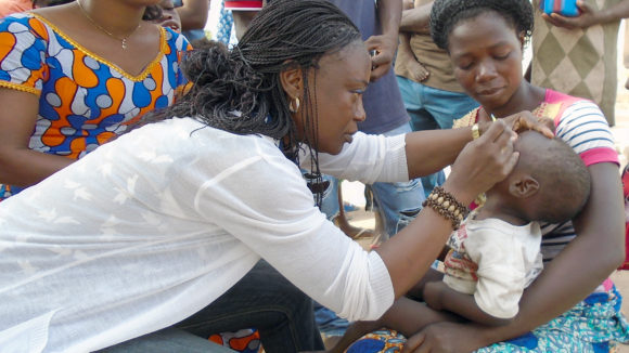 A child in Cote d'Ivoire has their eyes checked for signs of trachoma.