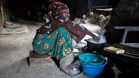 A woman with LF cleans her affected limb.