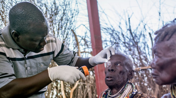 Eye surgeon Samson Lokele inspects a patient before her eye surgery.