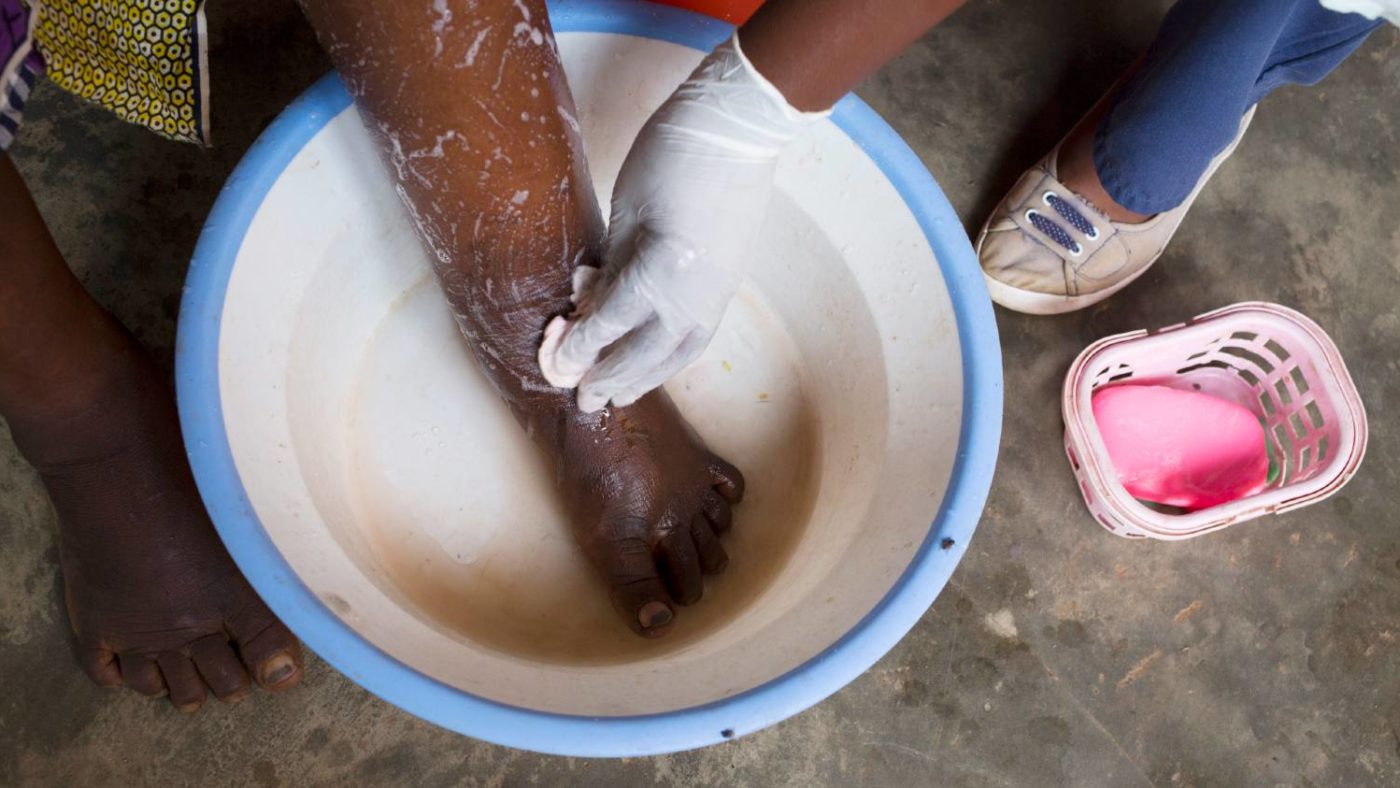 A close up of a leg being washed.