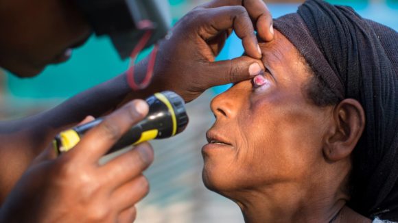 A lady's eye is examined with a torch