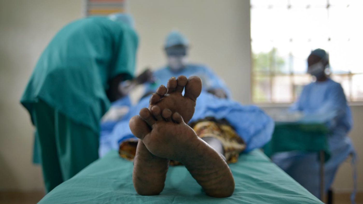 A woman lies on a hospital bed during surgery.