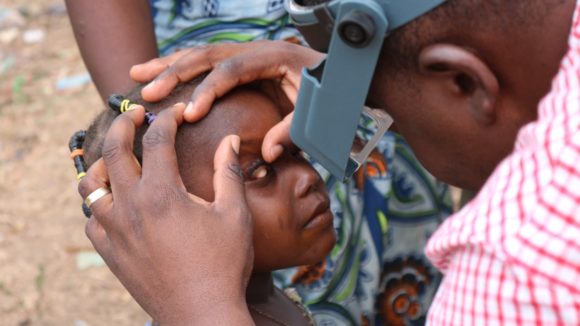 Young girl's eye is examined for trachoma