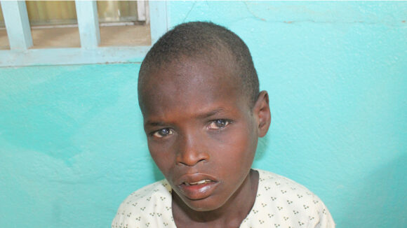 A boy looking at the camera wearing a hospital gown.