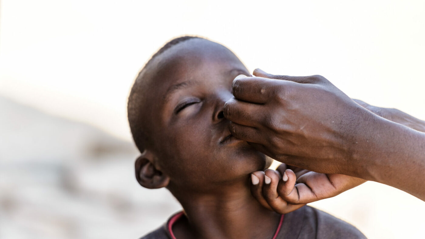 A young boy, Bretty, has ointment applied to his trachoma infected eye.