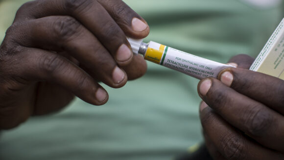 close up of hands holding a tube of ointment which is used for trachoma infections.