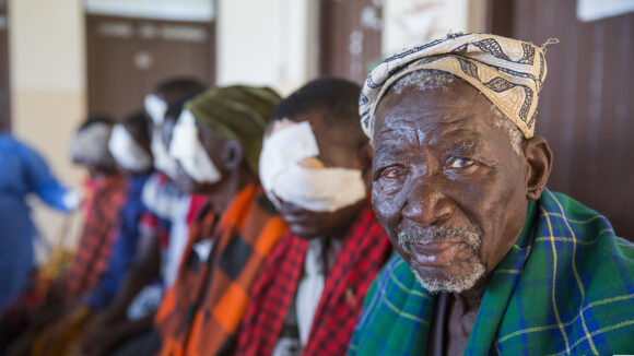 A man looks into the camera and smiles: one of his eyes is red after treatment for trachoma.