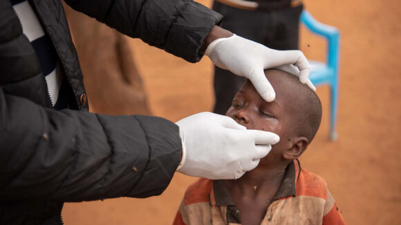 Naomi receives an application of ointment for her eyes to treat her trachoma infection