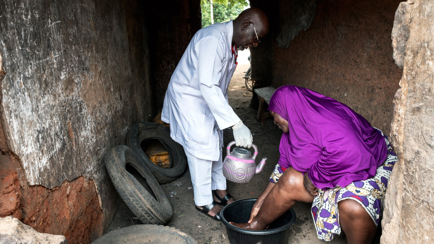 Salifat sits down with her right leg in a bowl. A health care worker stands next her pouring water on her leg from a teapot.