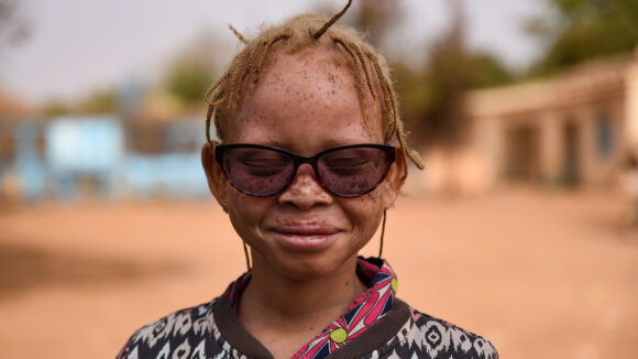 Aminata, who attends the National Institute for the Blind of Mali, smiles at the camera.