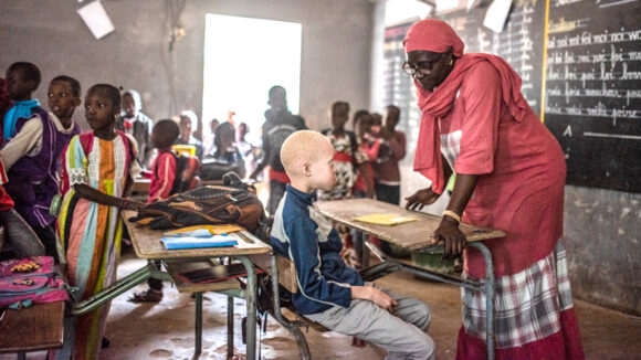 Teacher Awa Diop talks to a young visually impaired student with albinism.