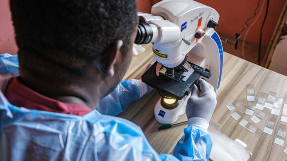 A lab scientist in Nigeria examines samples under a microscope.