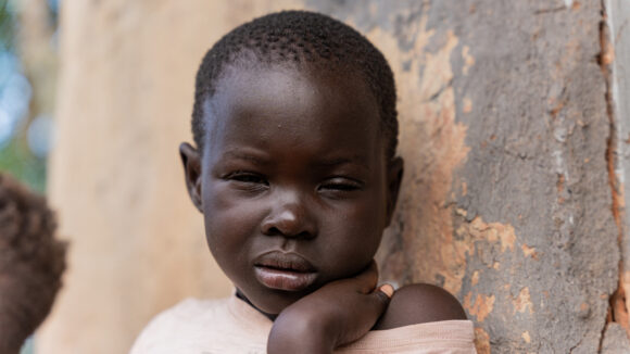 Six-year-old Happy winces in pain while sat outside her home in Uganda.