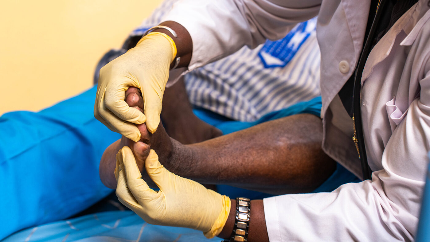 A health care worker treats someone with lymphatic filariasis, which has caused swelling in their lower leg.