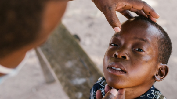 Mohamed looks up with his eyes open while his eyes are being examined