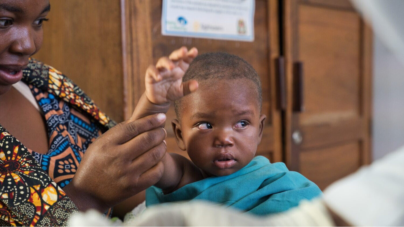 Ebenezeri looks at the doctor after having her bandages removed.