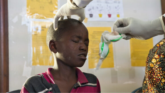 A doctor removes Joseph's bandages after cataract surgery.