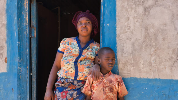 Rudia stands with her nephew Joseph, who is squinting due to cataracts. She is protectively resting her arm on Joseph's shoulder.