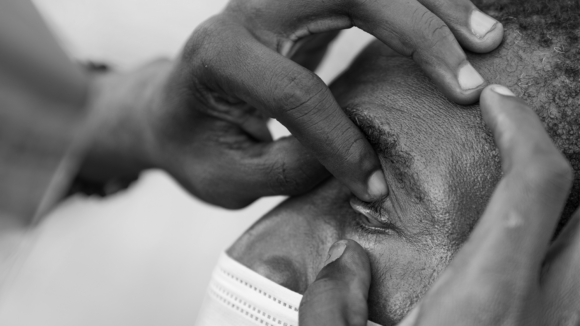 Close-up of an eye examination.