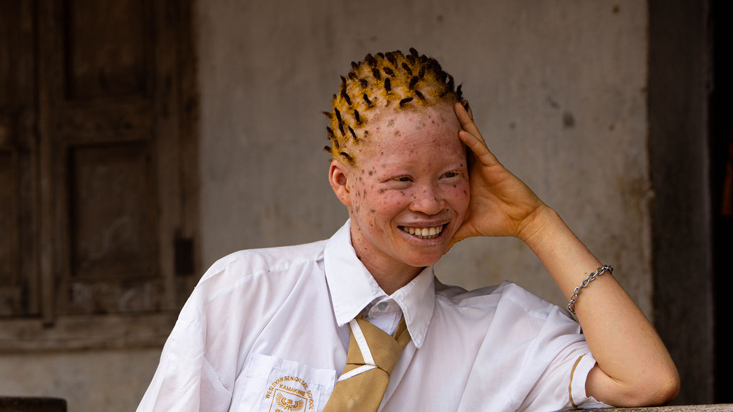 A woman with albinism leans on her arm. She is smiling broadly and wearing a shirt and tie.