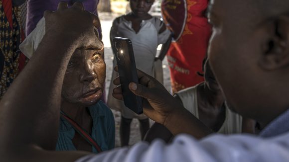 A health care worker examines a patient's eyes for signs of trachoma.